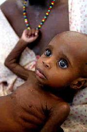 非洲饥荒儿童图片,生存边缘的挣扎与希望之光
