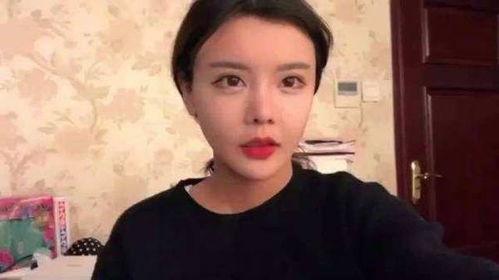 19岁网红整容,揭秘整容前后惊人变化